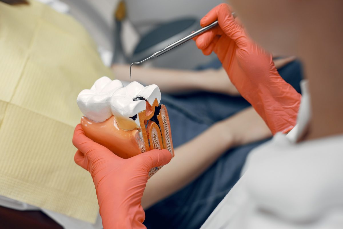 Odontóloga mostrando un modelo de diente con caries para explicar un tratamiento de endodoncia