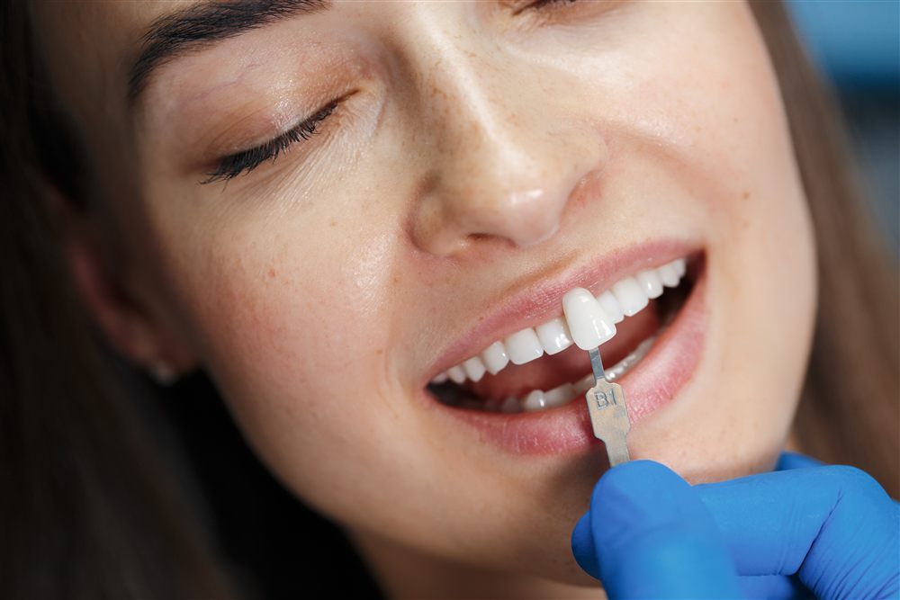 Resina dental estética